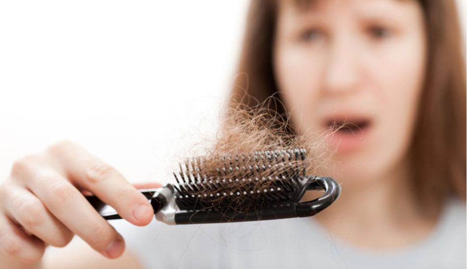 How-to-Prevent-Female-Pattern-Baldness