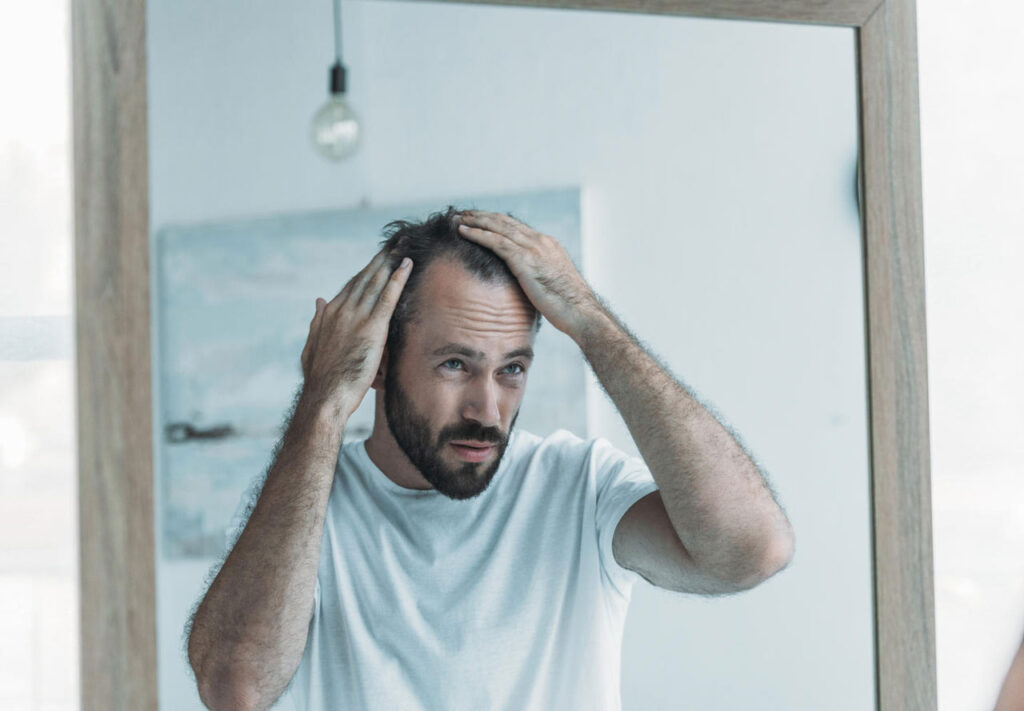Everything-you-need-to-know-about-hair-loss