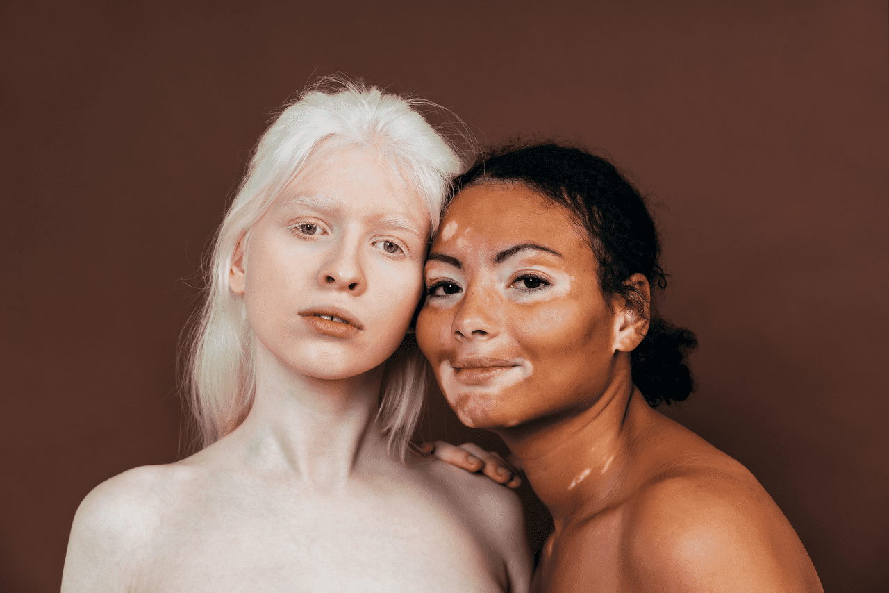 skin-coloration-diseases
