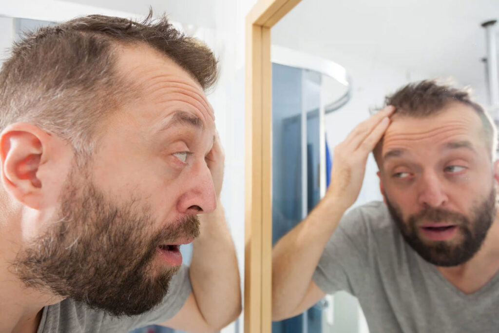 Mature Hair line
