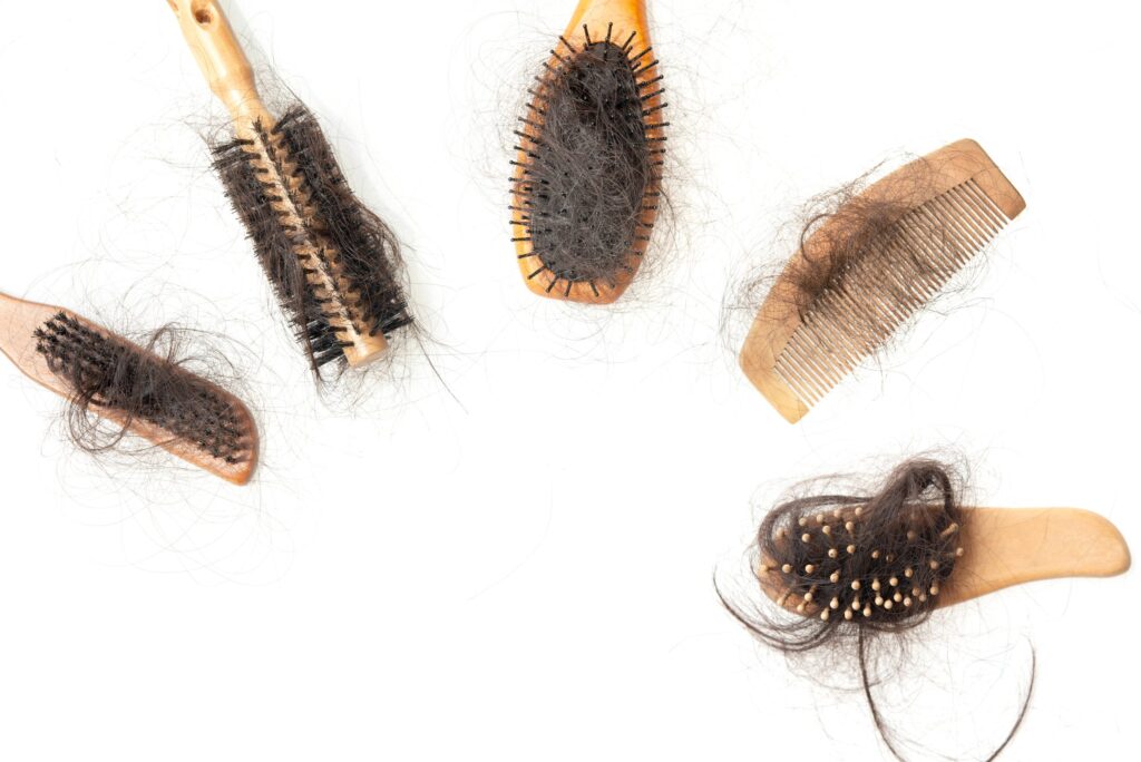 finasteride shedding scaled
