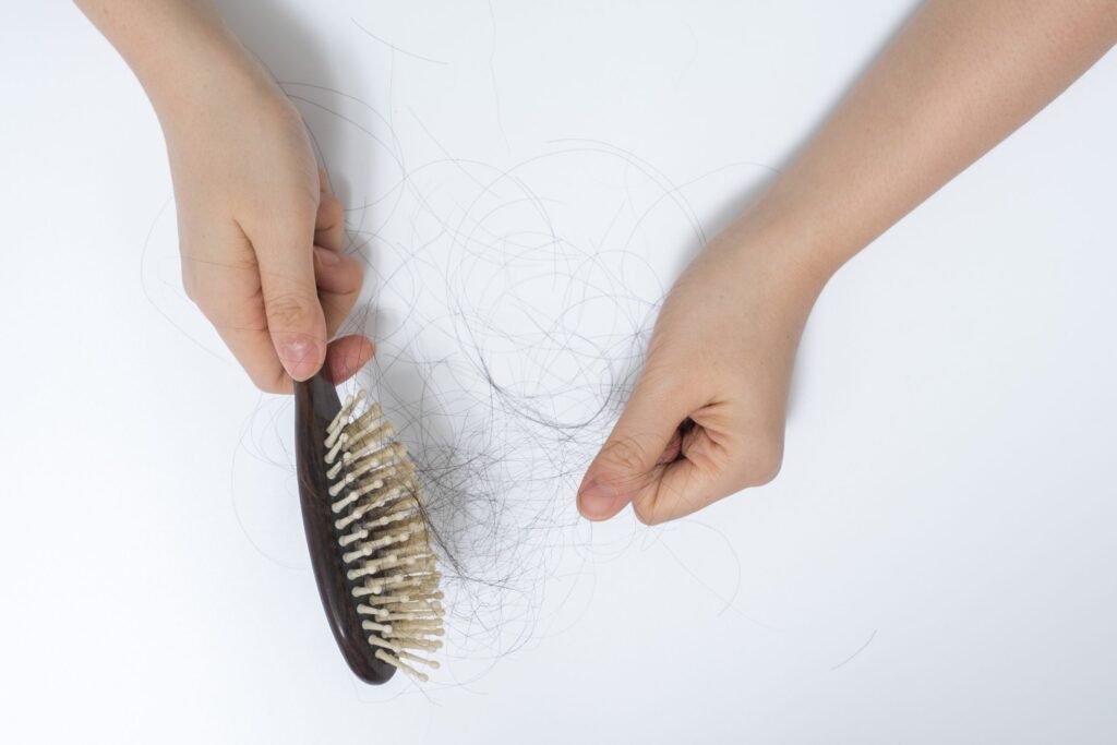 female celebrities hair loss