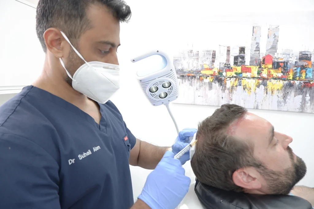 PRP Hair Treatment