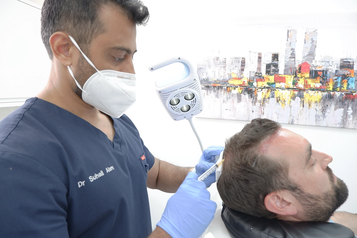 PRP Hair Treatment