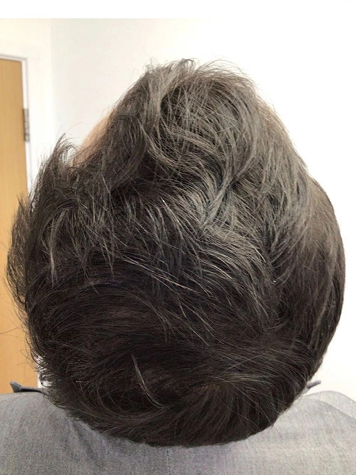 After