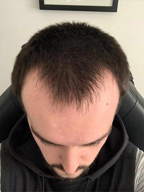 Before