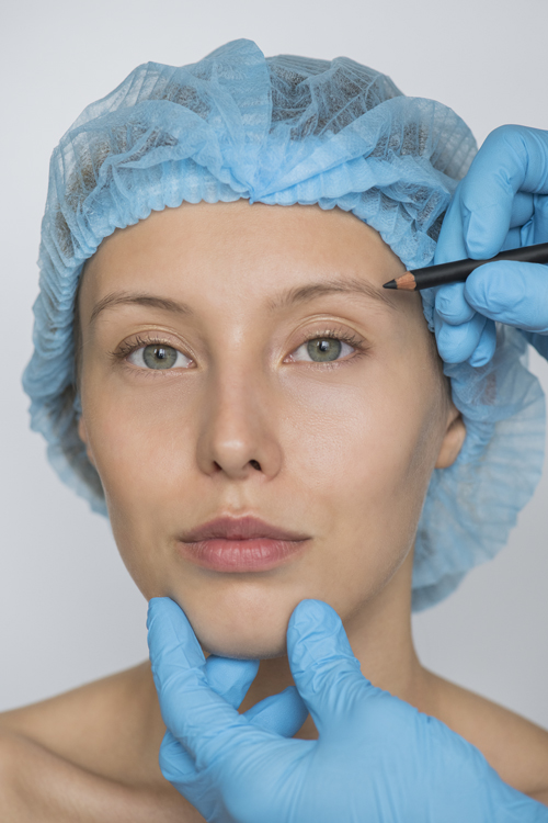 Eyebrow-Transplant