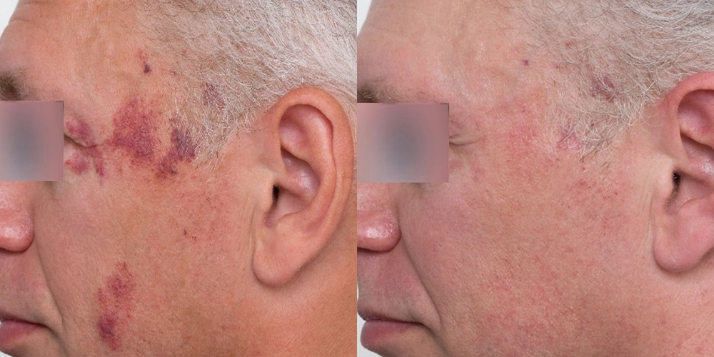 Nordly-Before-And-After-2