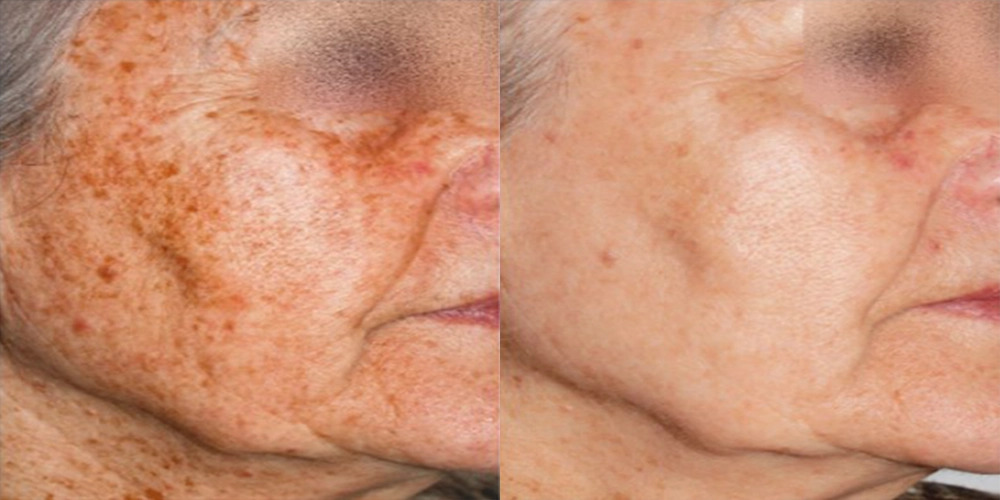 Nordly-Before-And-After-4