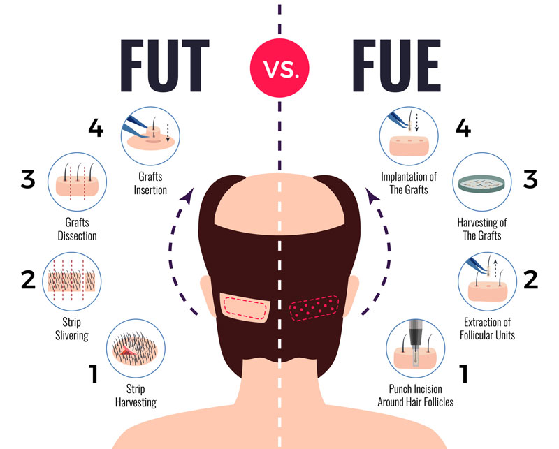 fue vs fut