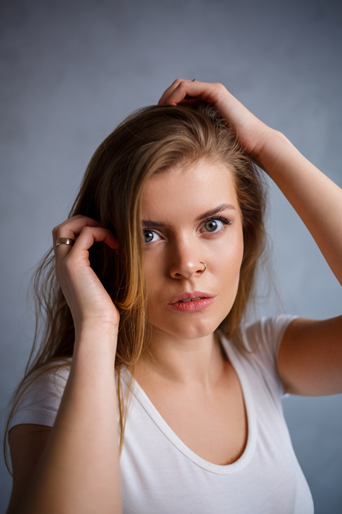 Women Hair Transplant
