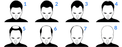 Hair Loss