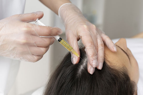 PRP-Therapy