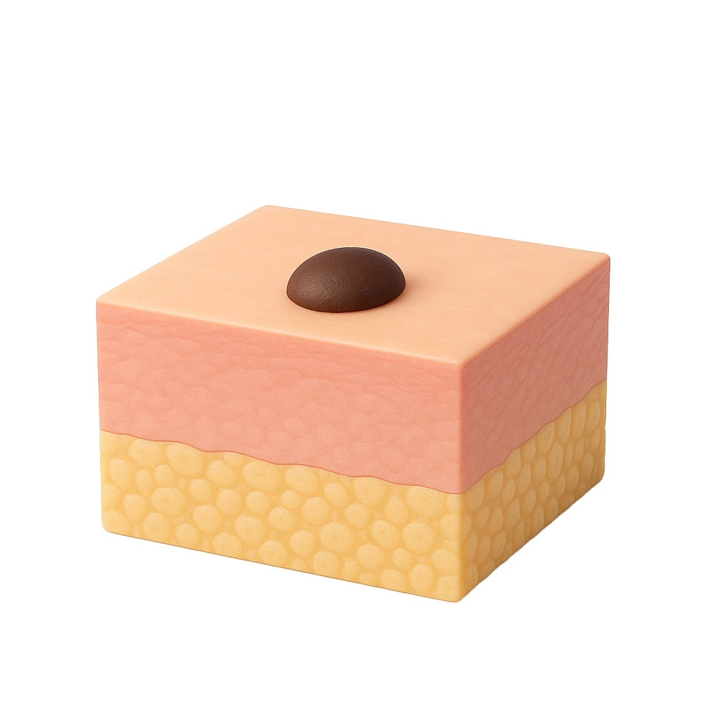 Mole Removal Graphic