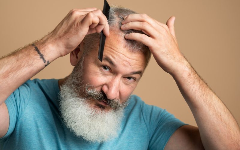 Man Combing Hair With Minoxidil