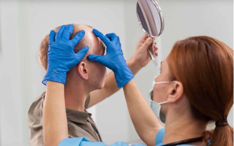 Alopecia-Hair-Assessment