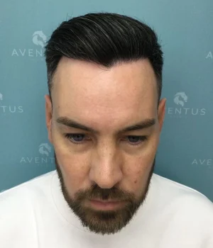 Ben-After-1