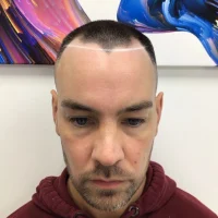 Ben-Before
