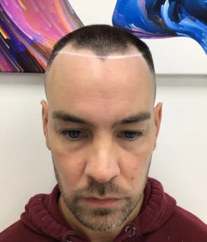 Ben-Before
