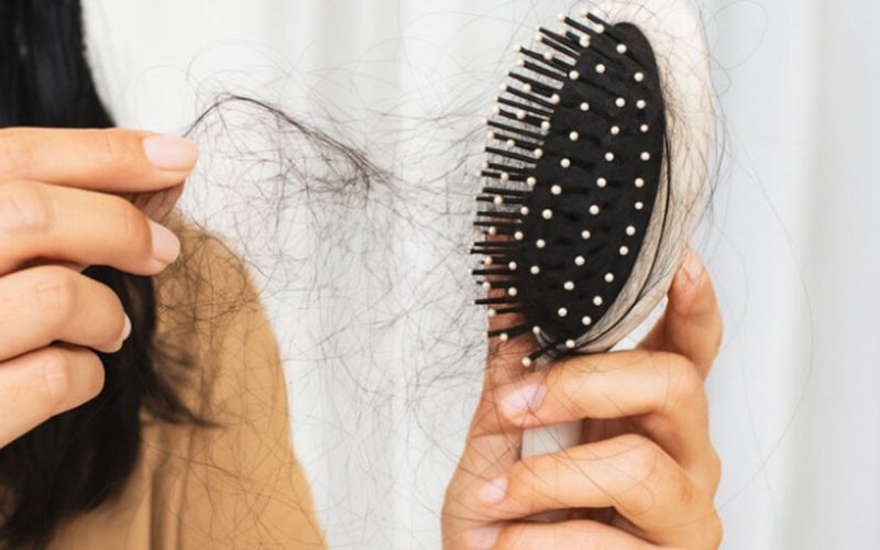 Hair-Loss