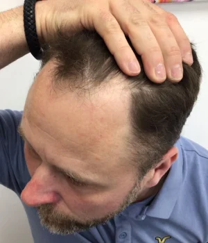 Lee-Before