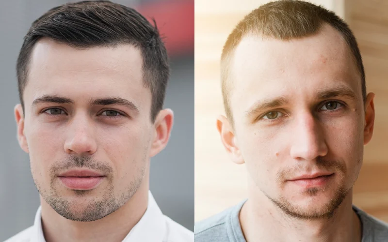 Mature-Hairline-Vs-Receding-Hairline