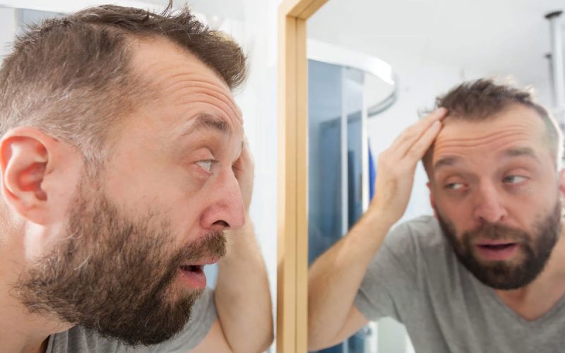 Mature Hair line