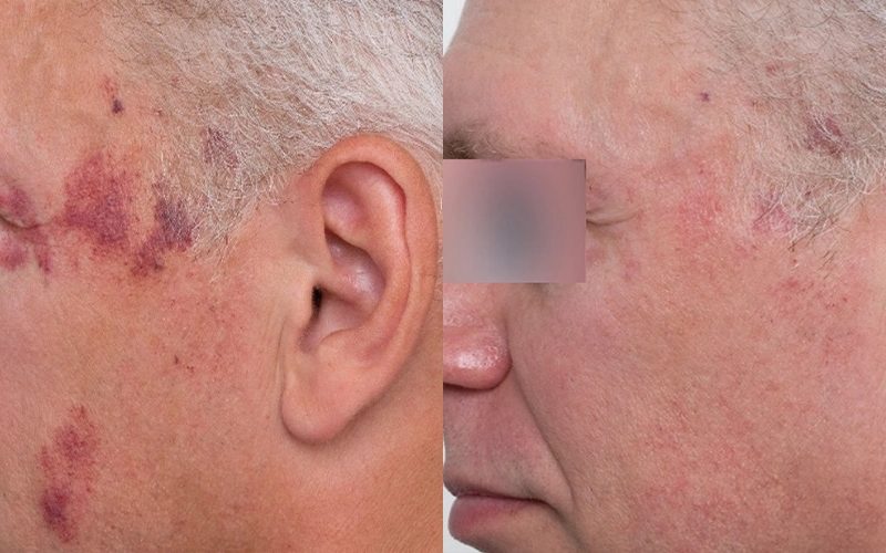 Nordly-Before-And-After-2