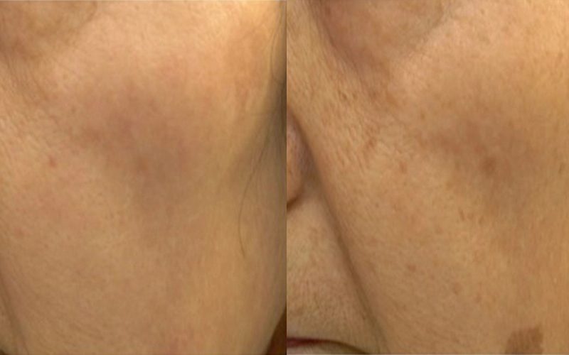 Nordly-Before-And-After-3