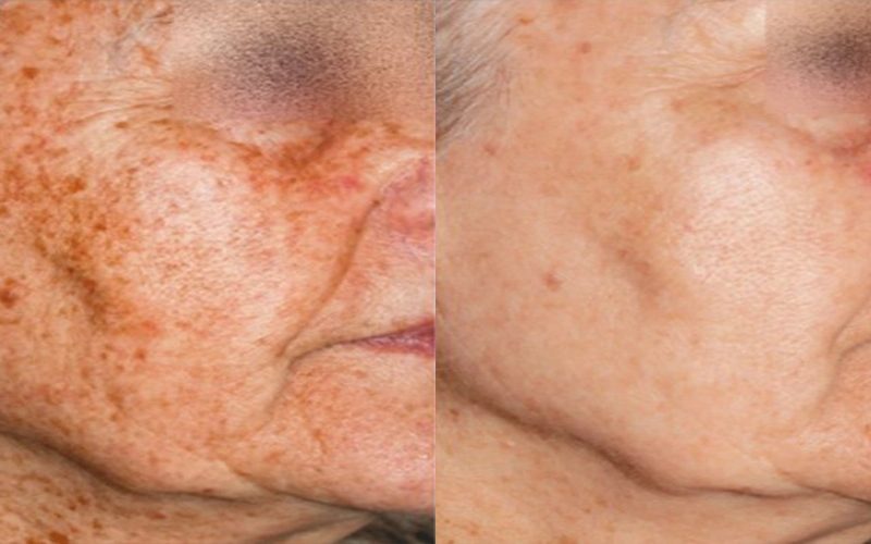 Nordly-Before-And-After-4