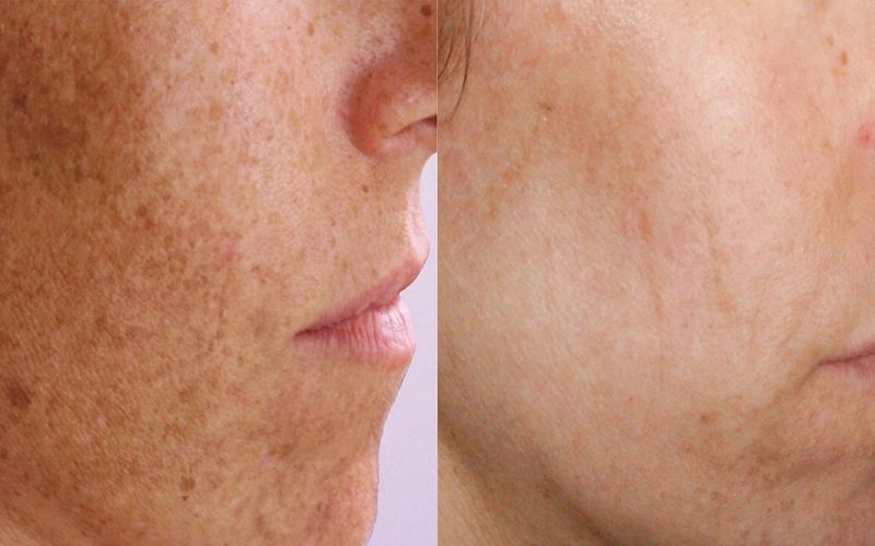 Nordly-Before-And-After-5