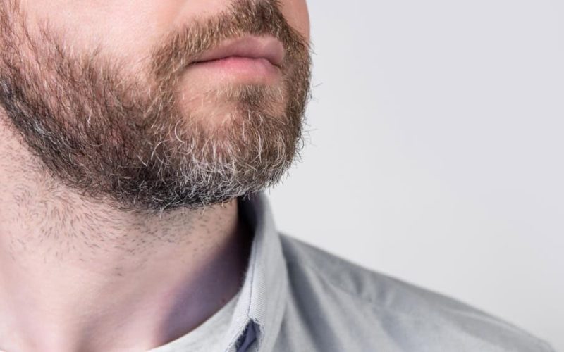Patchy-Beard