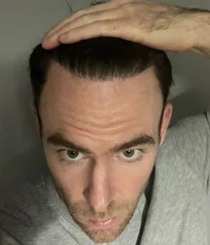 Stephen-After