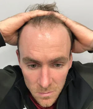 Stephen-Before