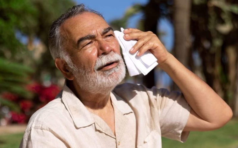 UK Skin in hot summers