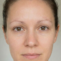 before eyebrow transplant 3