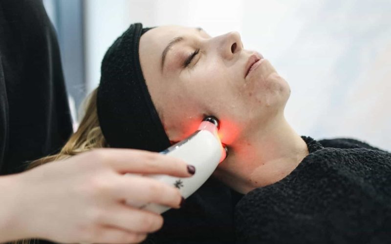 facial-laser-for-acne-prone-skin (1)
