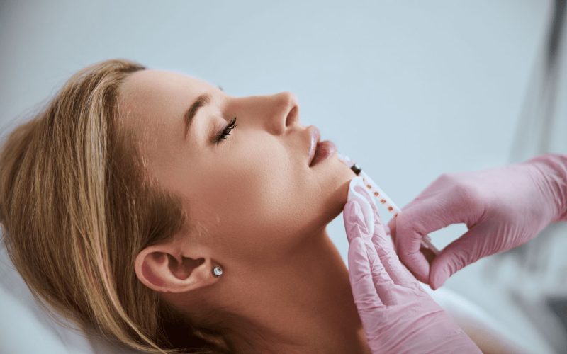 Lip Filler Swelling Stages